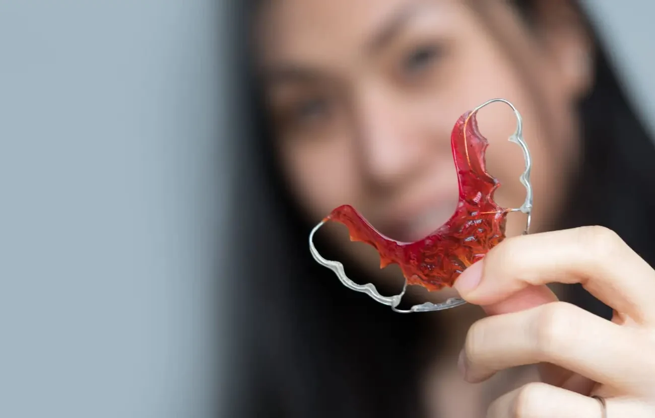 Custom orthodontic retainer designed to help maintain tooth alignment and protect long-term smile results after treatment.